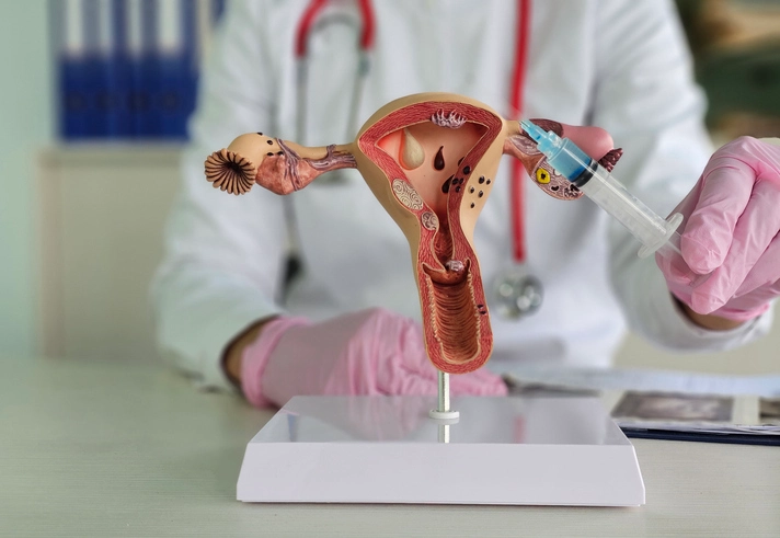Is cervical cancer preventable?