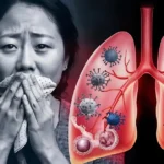 Woman coughing with infected lungs showing respiratory contagion.