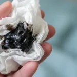 Hand holding a tissue with black mucus.