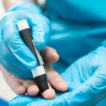 Blood glucose test illustrating genetic causes of diabetes