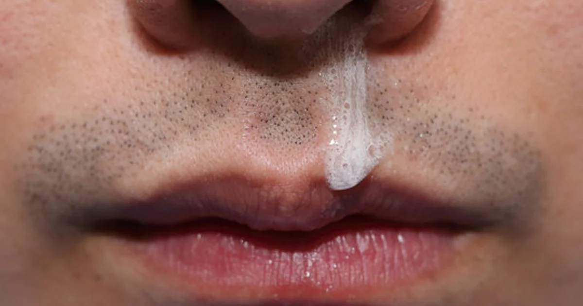 What Is Mucus?