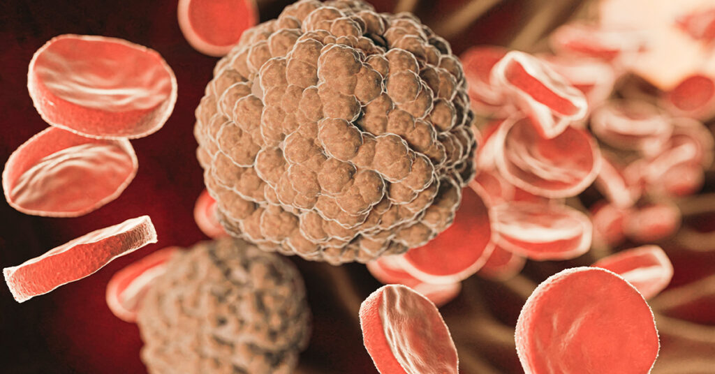 A 3D medical illustration showing a large, textured microscopic pathogen or tumor cell surrounded by red blood cells.