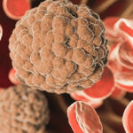 A 3D medical illustration showing a large, textured microscopic pathogen or tumor cell surrounded by red blood cells.