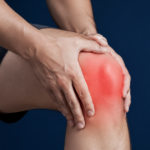 Man holding a swollen red knee in pain.