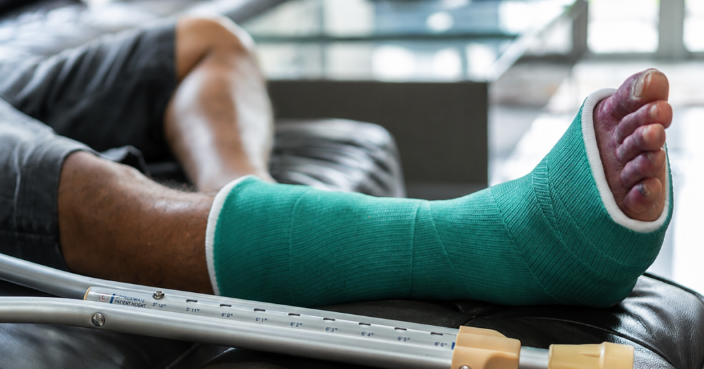 Close-up of a leg in a green cast with crutches nearby.