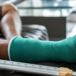 Close-up of a leg in a green cast with crutches nearby.