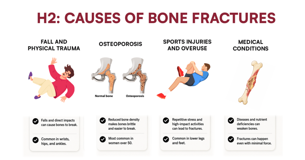 Infographic showing common causes of bone fractures.