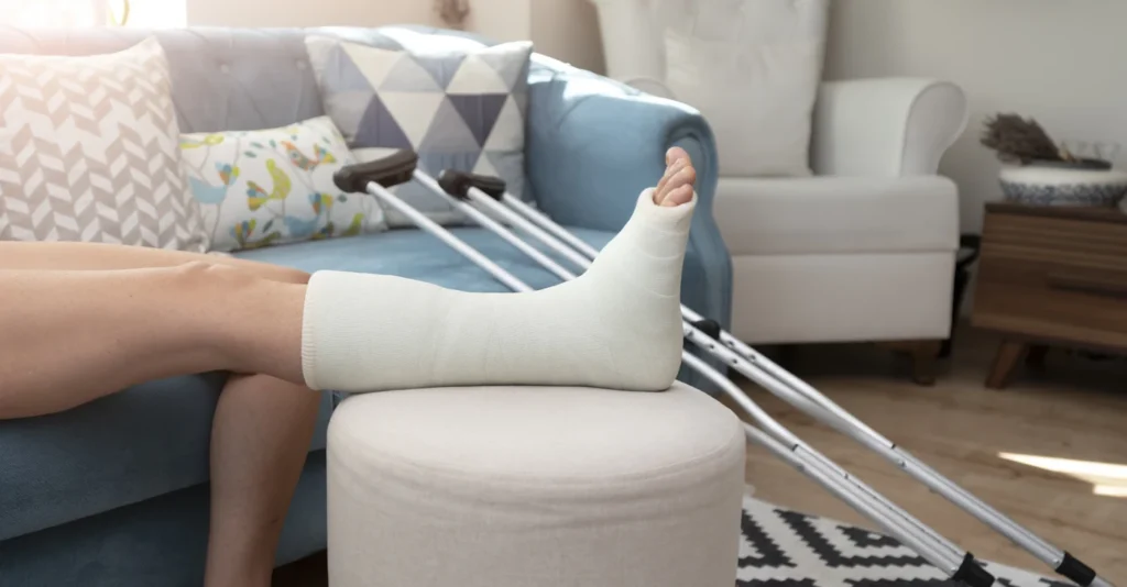 broken-ankle-leg-cast