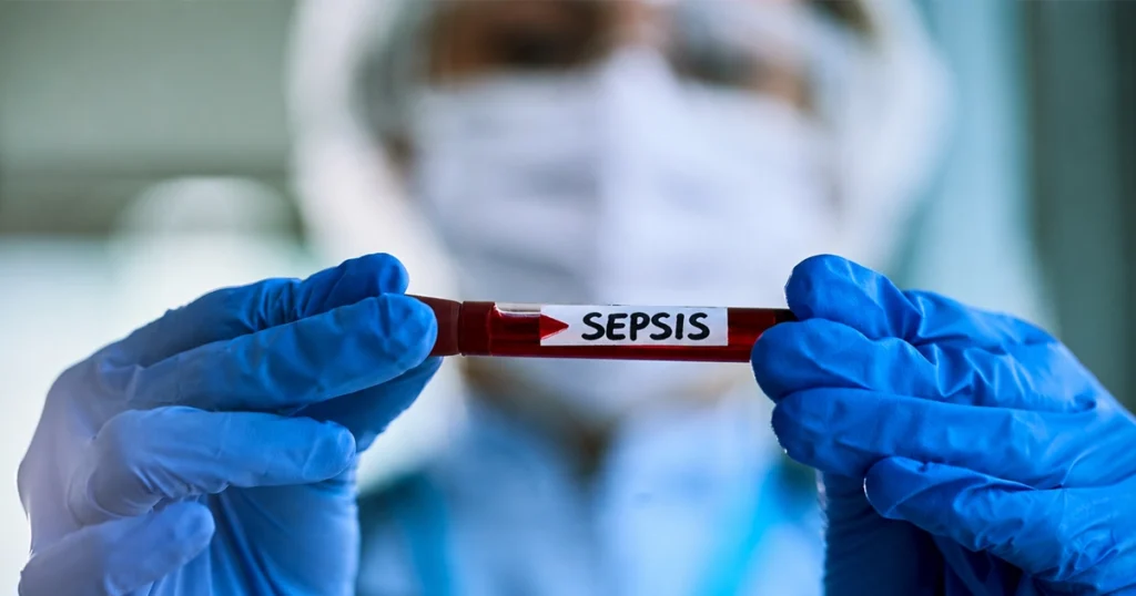 Healthcare worker holding a blood sample labeled “Sepsis.”