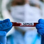 Healthcare worker holding a blood sample labeled “Sepsis.”