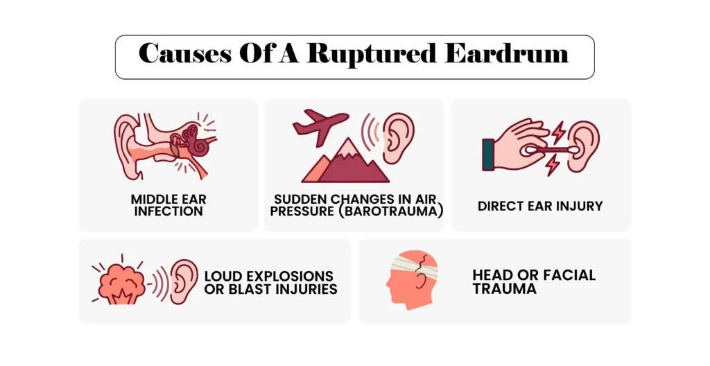 An infographic displaying five common causes of a ruptured eardrum