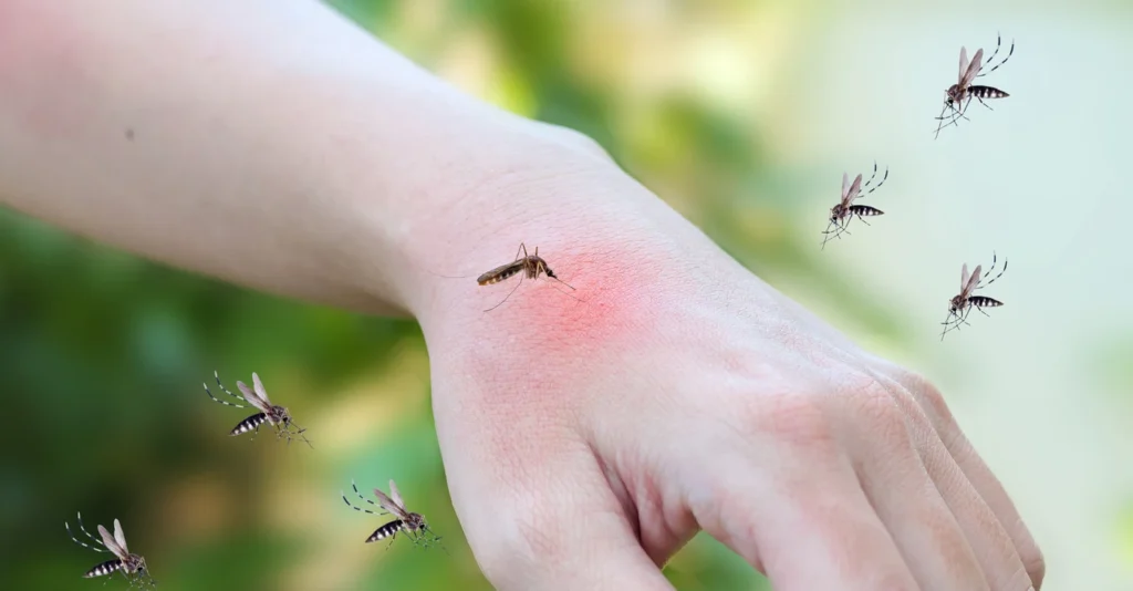 mosquitoes-bite-adult-hand-made-skin-rash-allergy-with-red-spot