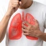Man coughing with pleurisy chest pain